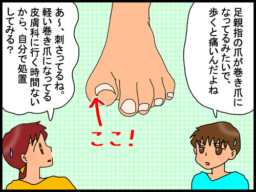 軽い巻き爪になった時の処置方法と爪にまつわる方言 としごと しごとと